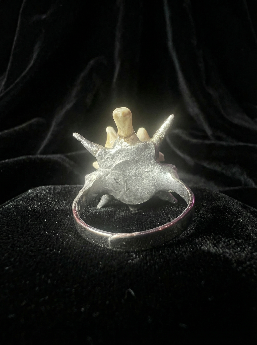 Vertebral Burst Ring